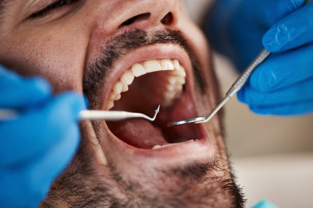 Best Emergency Dental Services for Seniors in Ayden, NC