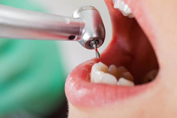 Best Orthodontic Emergency Dentist in Ayden, NC